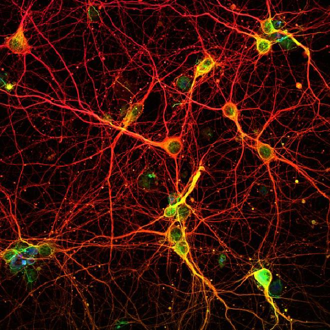 neuronal net